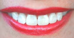 Fähigkeiten der zahnbehandlung. Dental care.